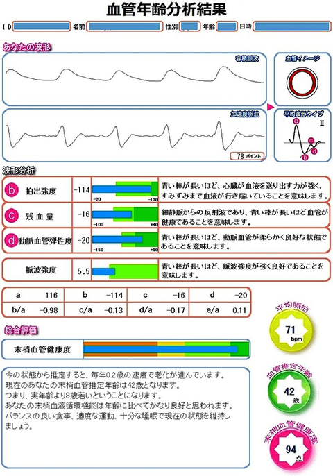 ストレス「自律神経バランス分析器」 | 次世代の健康づくりをめざすバイオロジックヘルス株式会社